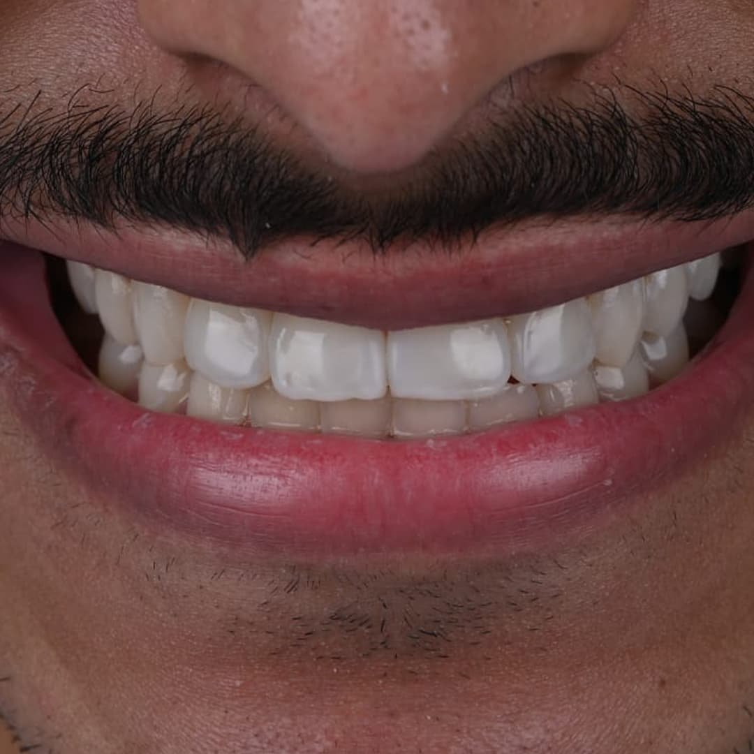 بعد
