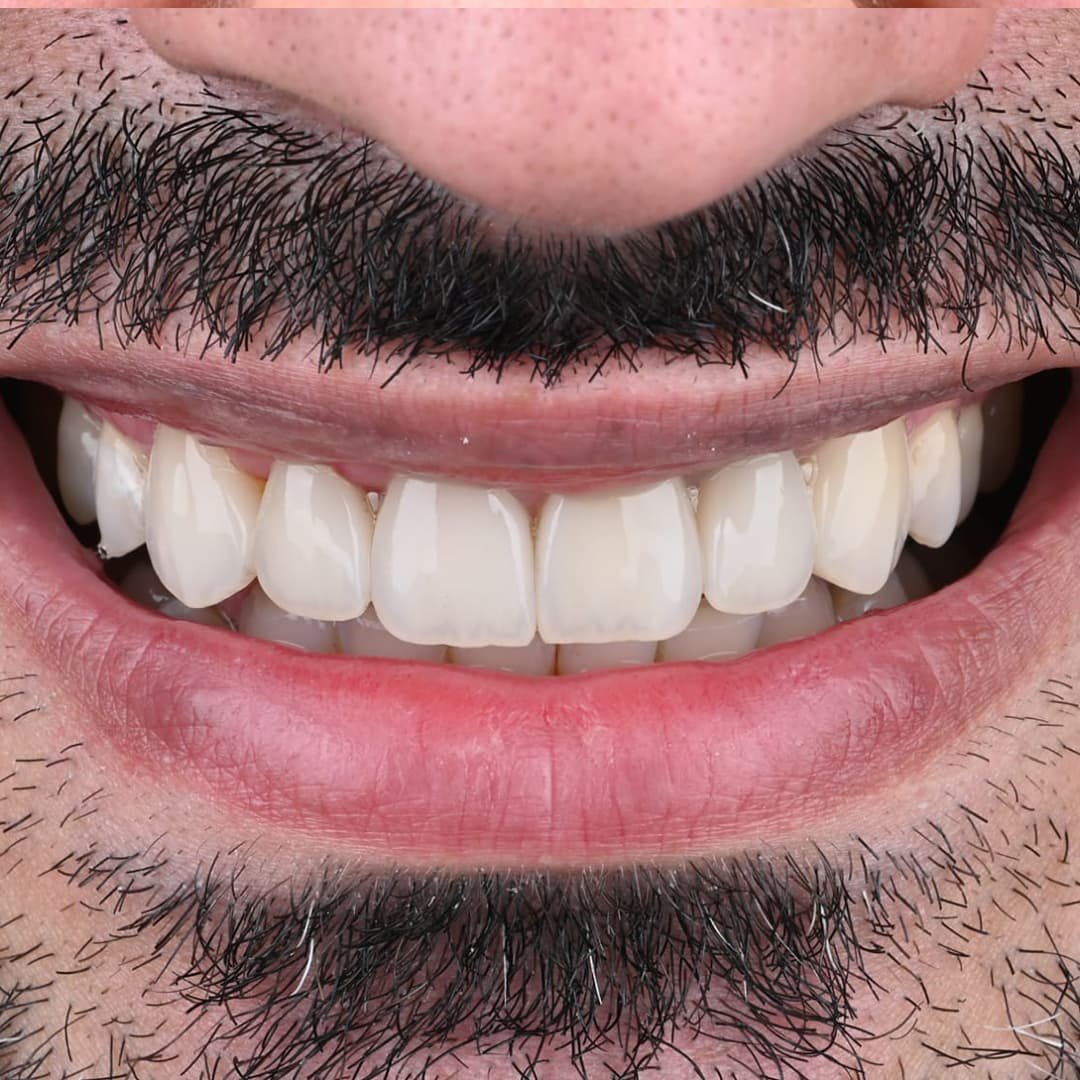 بعد