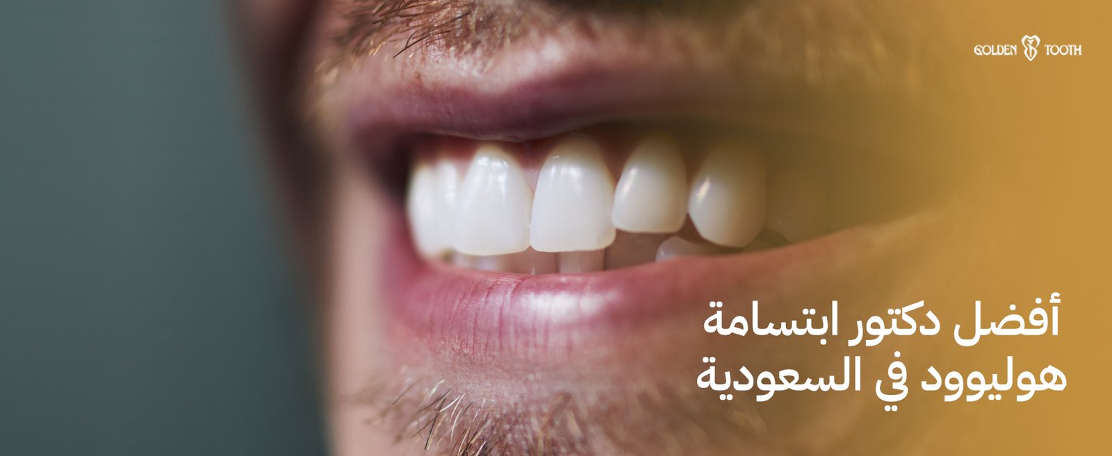 أفضل دكتور ابتسامة هوليوود في السعودية