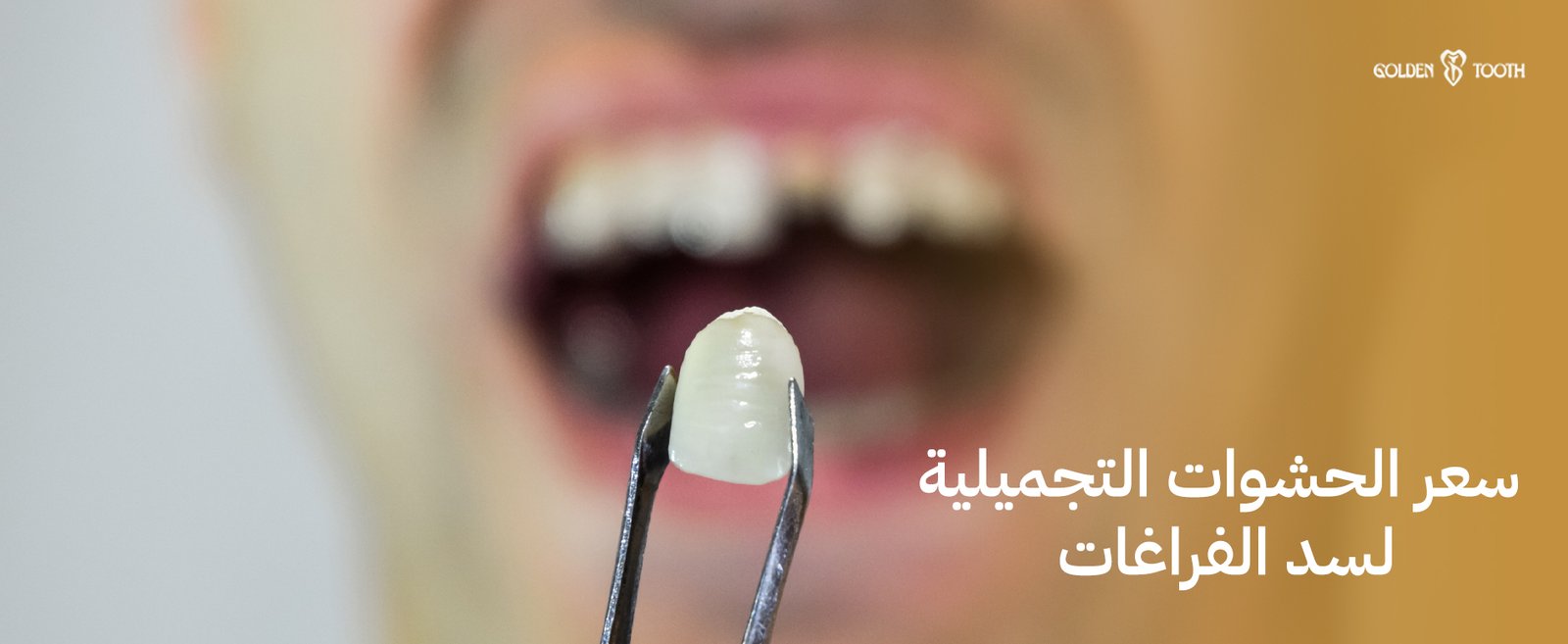 سعر الحشوات التجميلية لسد الفراغات
