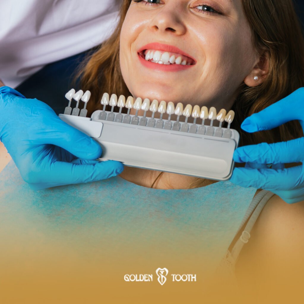 عمليات تجميل الأسنان