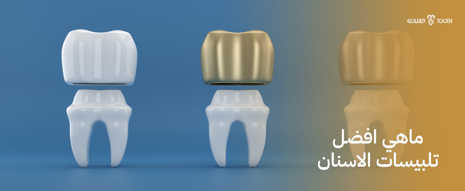 ماهي افضل تلبيسات الاسنان