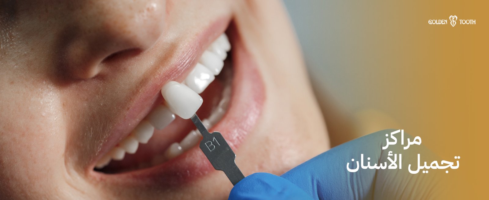 مراكز تجميل الأسنان